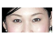 什么是“红眼”现象？如何减轻“红眼”